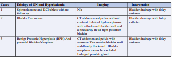 Table 3: Etiology of Obstructive Nephropathy (ON) and Hyperkalemia in our Cases.