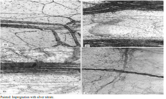 Figure 1: Norm. membrane preparation. A) Branching of hemocapillaries and formation of collecting venules; B) The collecting venule, a rteriole and group of lymphcapillaries form a microcirculatory vascular fascicle; C) System of lymphcapillaries connecting two microcirculatory fasciclesÃ?Â??Ã?Â???Ã?Â??Ã?Â????Ã?Â??Ã?Â???Ã?Â??Ã?Â???Ã?Â??Ã?Â???Ã?Â??Ã?Â??Ã?Â??Ã?Â?Ã?Â¢??Ã?Â??Ã?Â???Ã?Â??Ã?Â????Ã?Â??Ã?Â???Ã?Â??Ã?Â???Ã?Â??Ã?Â???Ã?Â??Ã?Â??Ã?Â??Ã?Â?Ã?Â¢??vascular triadsÃ?Â??Ã?Â???Ã?Â??Ã?Â????Ã?Â??Ã?Â???Ã?Â??Ã?Â???Ã?Â??Ã?Â???Ã?Â??Ã?Â??Ã?Â??Ã?Â?Ã?Â¢?Ã?Â??Ã?Â???Ã?Â??Ã?Â????Ã?Â??Ã?Â???Ã?Â??Ã?Â???Ã?Â??Ã?Â???Ã?Â??Ã?Â??Ã?Â??Ã?Â?Ã?Â in the pancreas; D) Net of lymphatic capillaries intersects with a nerve fiber that is well impregnated with silver nitrate according V.V.Kupriyanov