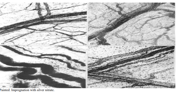 Figure 2: State of microhemolymphcirculation 12 hours after modeling acute pancreatitis: A) System of lymphatic and blood capillaries, occlusion of individual vessels by microthrombi; B) Hemocapillaries form a collecting venule, filled with formed elements of blood; C) A mass of indigocarmine fills large lymphatic vessels; D) The vascular net maintains the conditions for microcirculation in the lymph and hemocapillary system